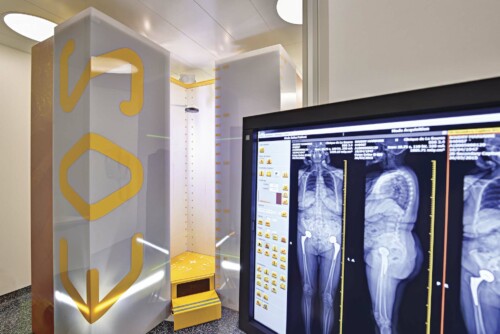 Radiographie EOS basse dose à Paris 12