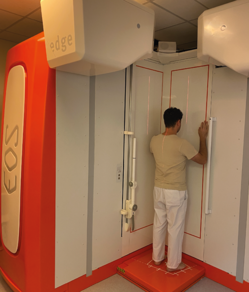 Reconstruction 3D du squelette par examen EOS